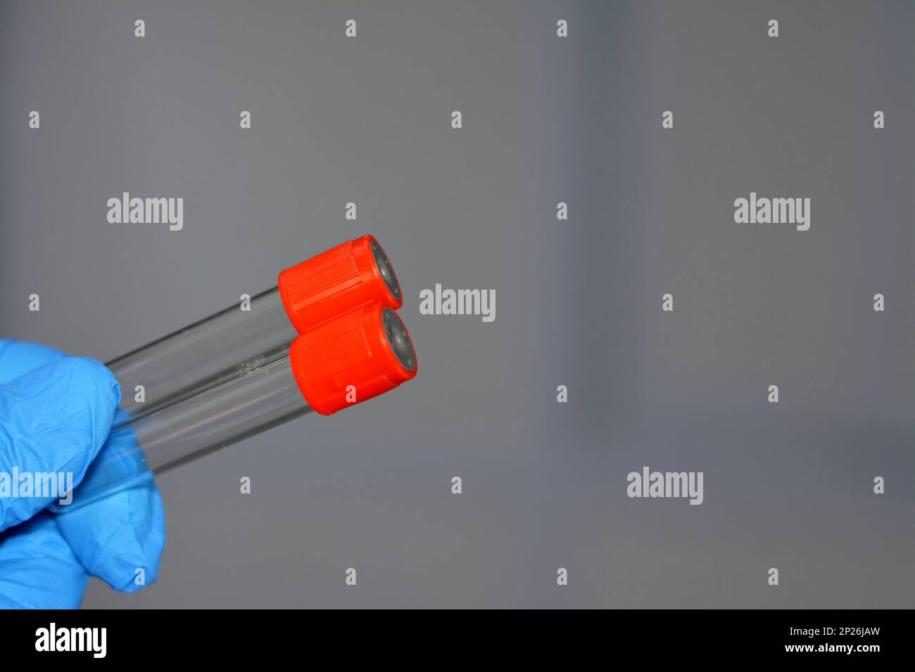 Provetta per il prelievo ematico per il prelievo di campioni ematici per analisi di laboratorio quali conta ematica completa CBC, ESR, CRP, FBS, HbA1c, reni e fegato Foto Stock