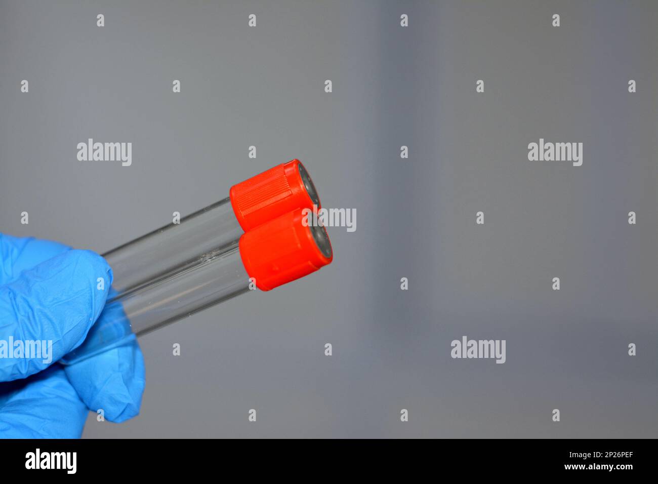 Provetta per il prelievo ematico per il prelievo di campioni ematici per analisi di laboratorio quali conta ematica completa CBC, ESR, CRP, FBS, HbA1c, reni e fegato Foto Stock