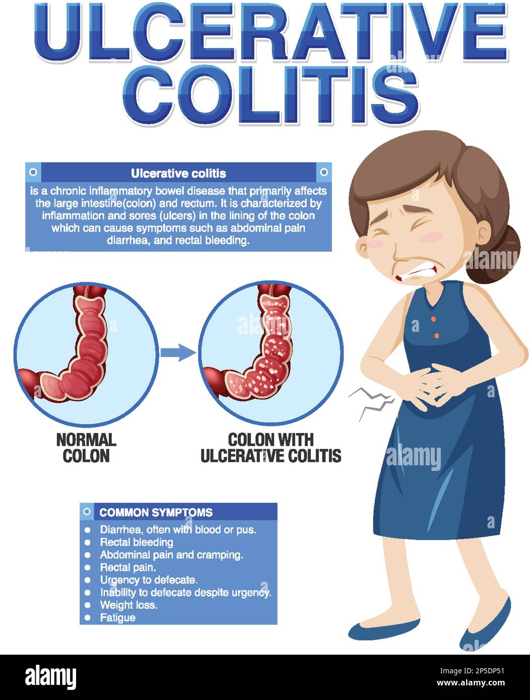 Sintomi della colite ulcerosa illustrazione infografica Illustrazione Vettoriale