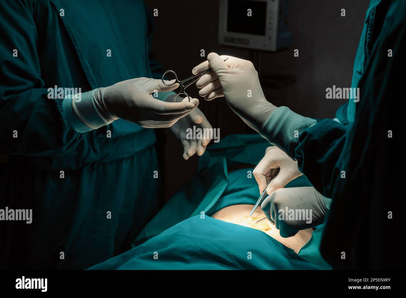 Immagine del team chirurgico eseguire l'operazione chirurgica, l'infermiere  distribuire le forbici sterili al chirurgo come supporto e cooperativa  nella sala operatoria concetto Foto stock - Alamy