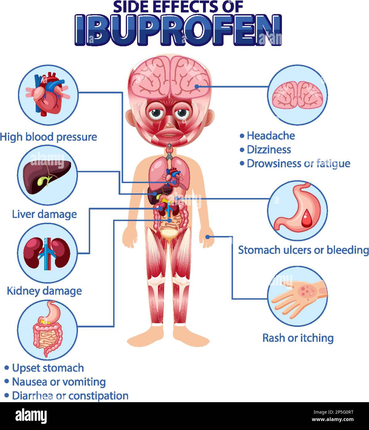 Anatomia umana diagramma cartoon stile di ibuprofene effetti collaterali  illustrazione Immagine e Vettoriale - Alamy