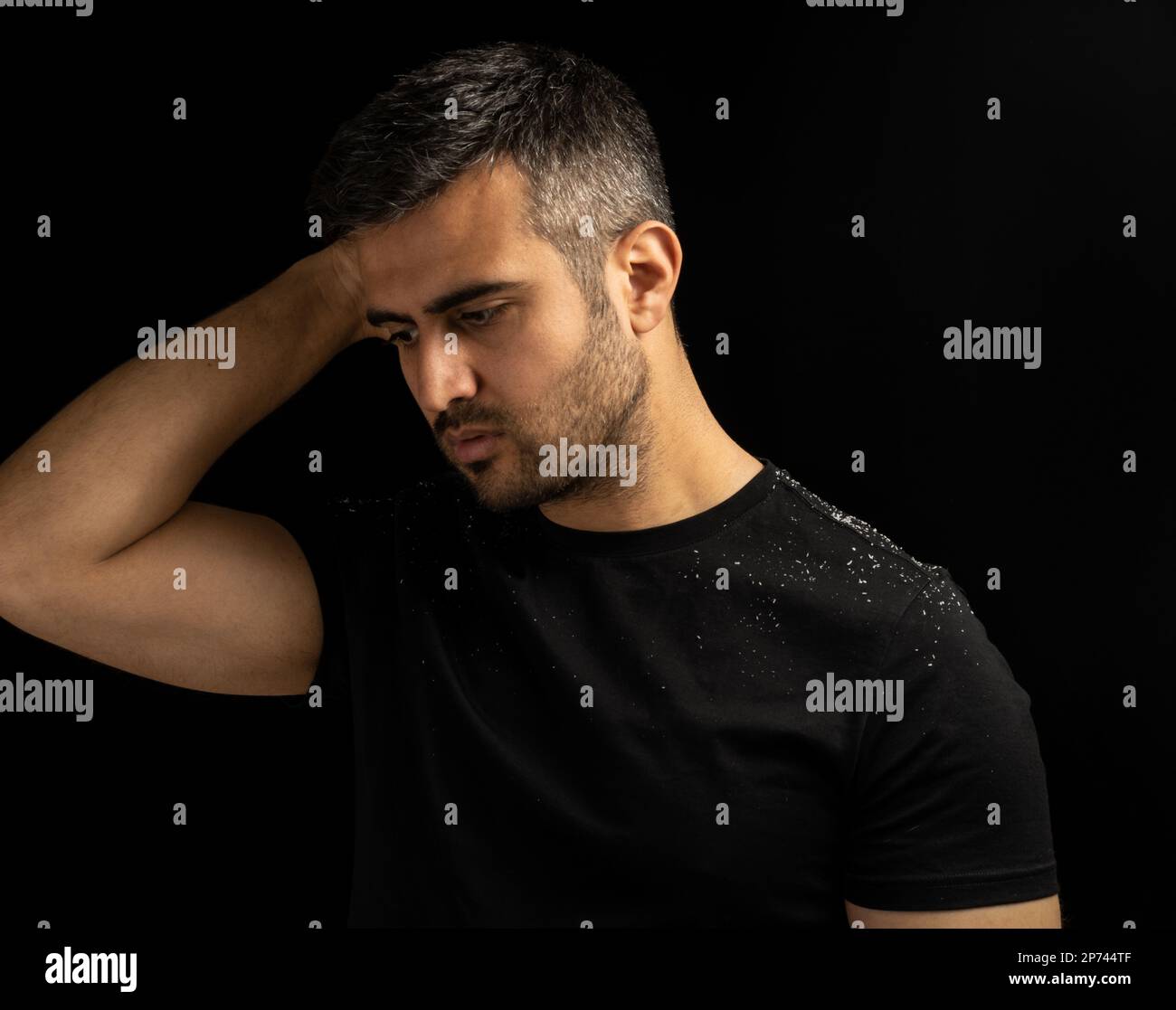 Primo piano basso ritratto chiave di un uomo con forfora o prurito problema dei capelli. Concetto di cura dei capelli, forfora e dermatite seborroica. Foto Stock