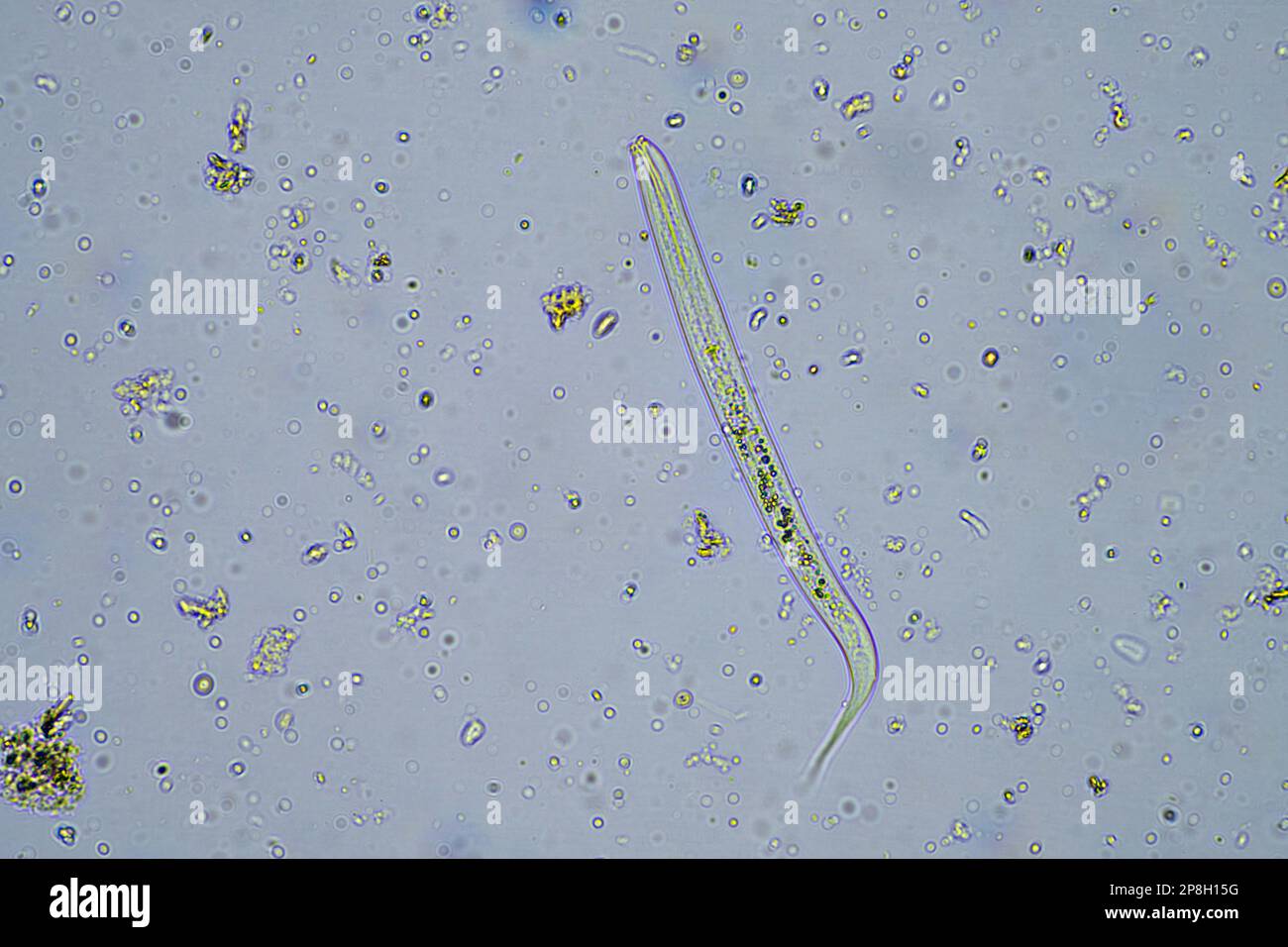 microorganismi e biologia del suolo, con nematodi e funghi al microscopio in un campione di compost del suolo Foto Stock
