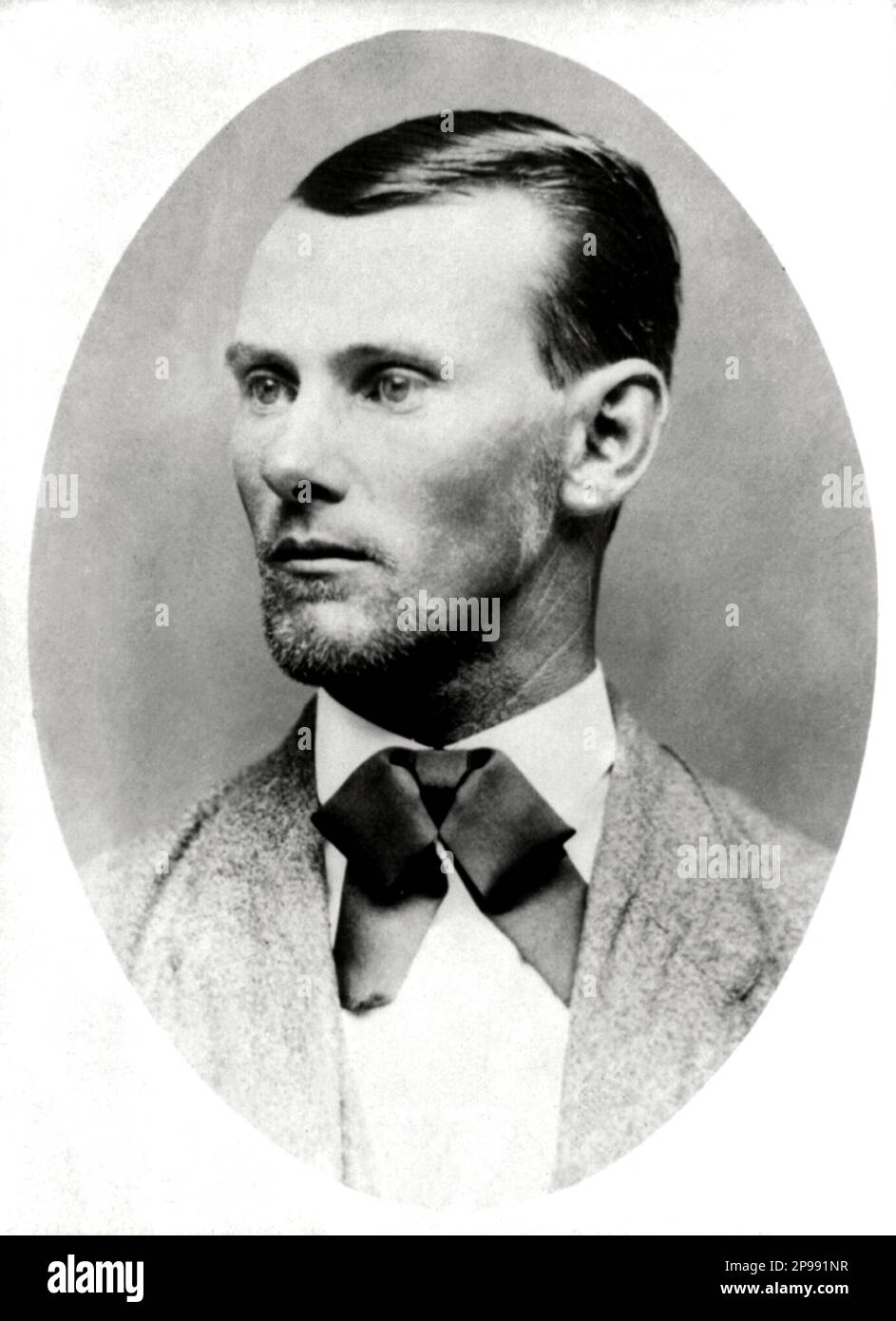 Il fuorilegge occidentale JESSE JAMES ( Jesse Woodson James 1847 - 1882 ) - Selvaggio WEST - epopea del - FUORILEGGE - bandito - colletto - cravatta papillon - cravatta - fiocco - barba - barba - barba - barba ---- Archivio GBB Foto Stock