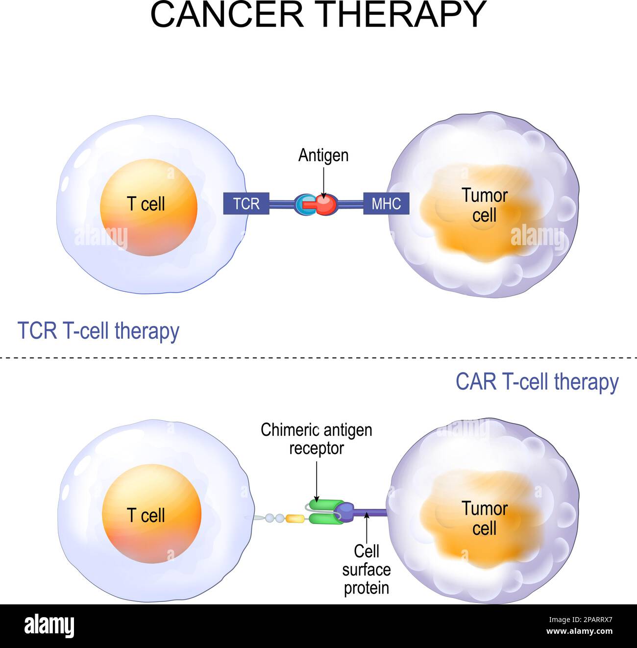 Trattamento del cancro. Terapia delle cellule T con recettore delle cellule T (TCR) o recettore dell'antigene chimerico (CAR). leucociti e cellule tumorali. Poster vettoriale Illustrazione Vettoriale