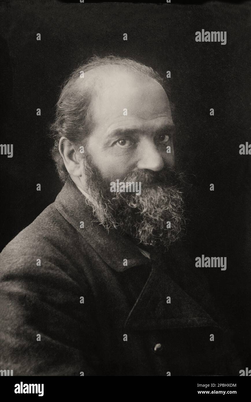 1905 ca: Lo scienziato tedesco Dottor ERNEST SCHWENINGER (1850-1924). Medico principale del grande ospedale distrettuale di Gross Lichterfelde, vicino Berlino. Ernst Schweninger era all'età di 33 anni già noto in tutto il mondo per essere il medico personale del principe otto von Bismarck . Nel 1884, il suo paziente grato lo fece capo del Dipartimento di Dermatologia di Berlino e professore di Dermatologia . Gli anni successivi sono stati segnati da lotte politiche all'interno dell'università, ma ha ancora prodotto un certo numero di pubblicazioni scientifiche ed è ancora ricordato per il suo primo descrip Foto Stock