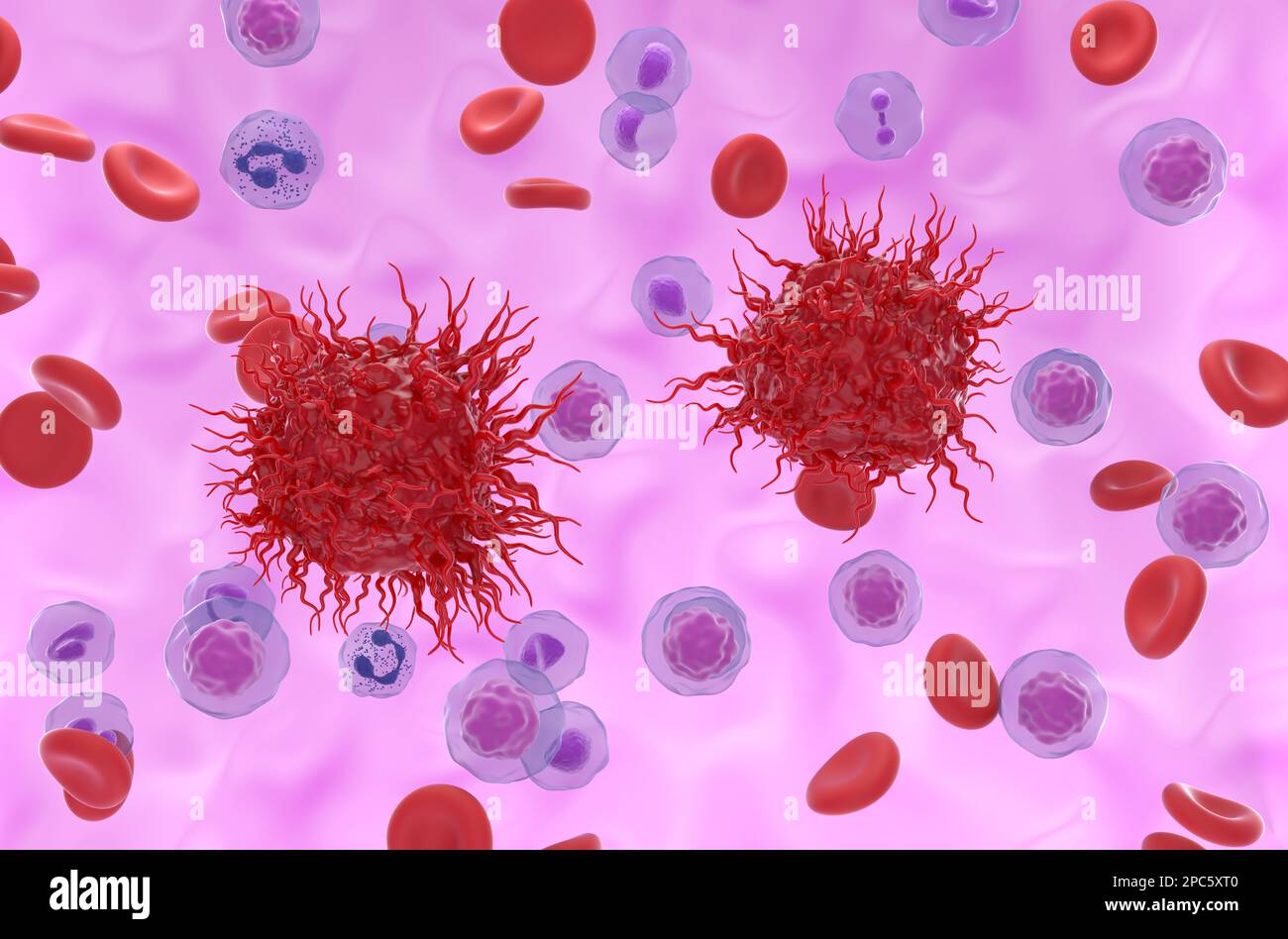 Cellule tumorali neuroendocrine metastatiche nel flusso sanguigno - 3D illustrazione vista isometrica Foto Stock