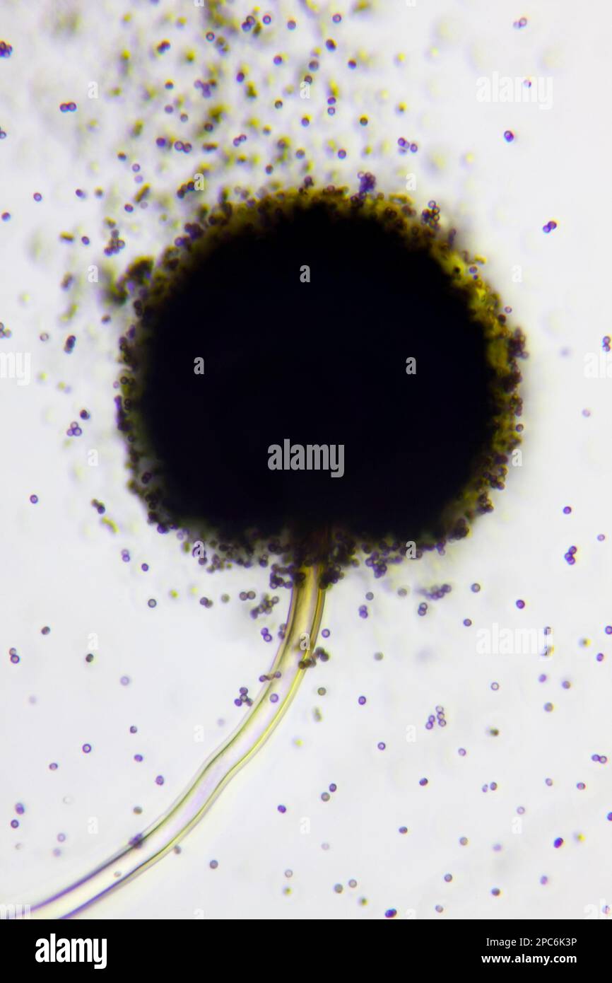Vista microscopica di una testa conica di muffa nera (Aspergillus niger) con spore. Illuminazione a campo chiaro. Foto Stock