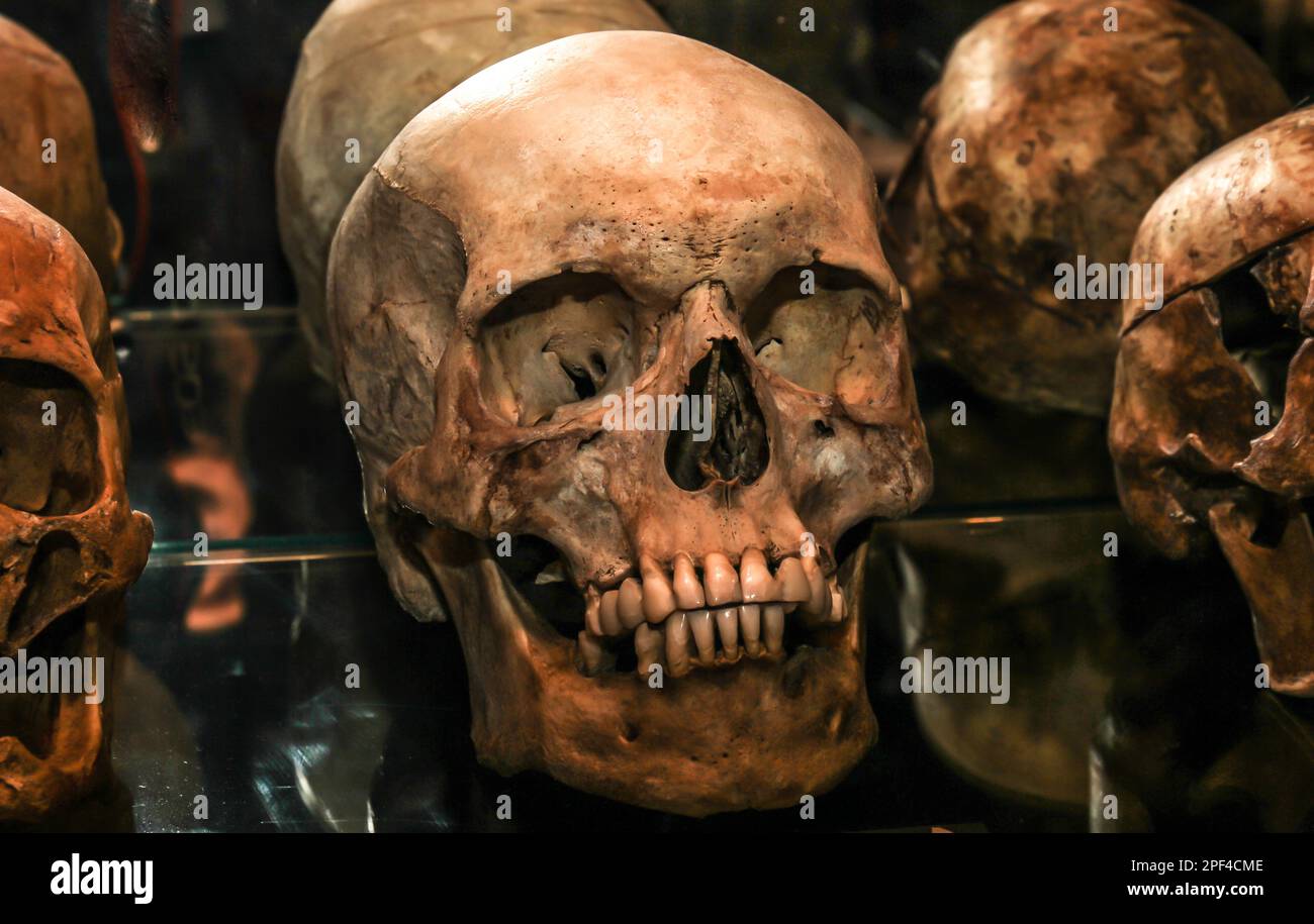 Primo piano di Fake Human cranio e denti Foto Stock