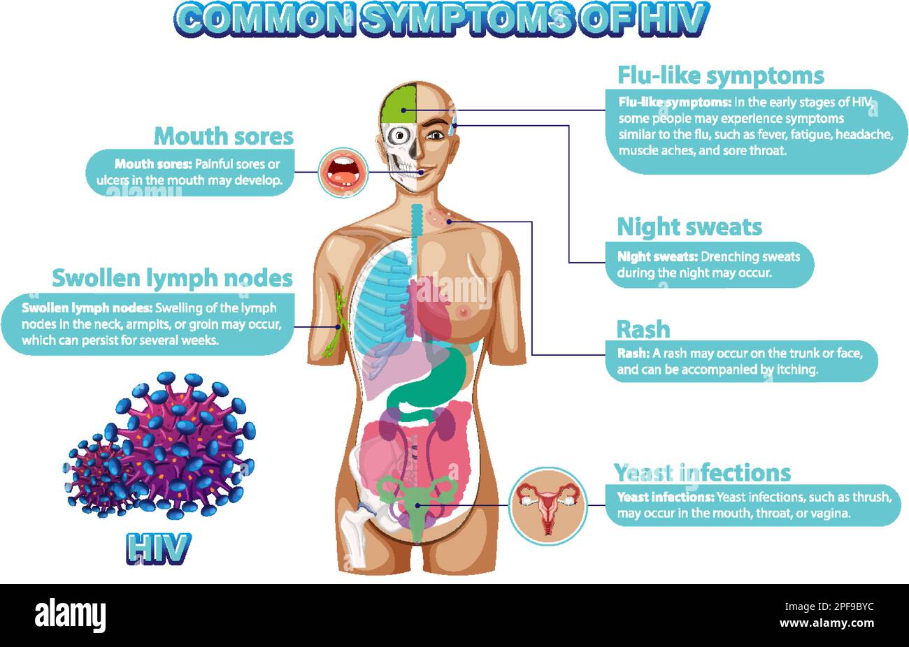 Poster informativo dei sintomi comuni di HIV illustrazione Illustrazione Vettoriale