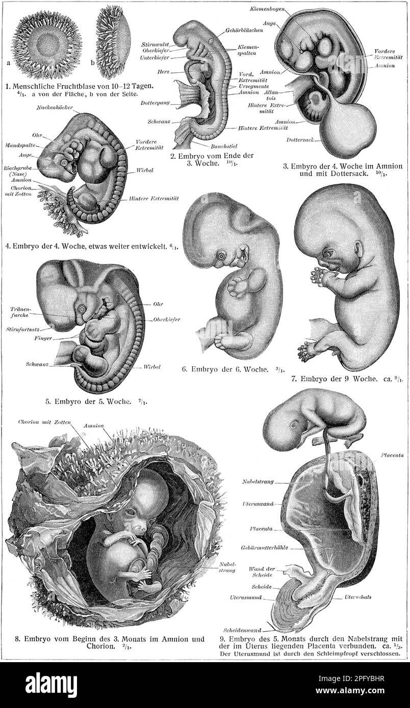 Fasi di sviluppo umano nell'utero, dall'ovulo, all'embrione fino alla nascita di un bambino. Foto Stock