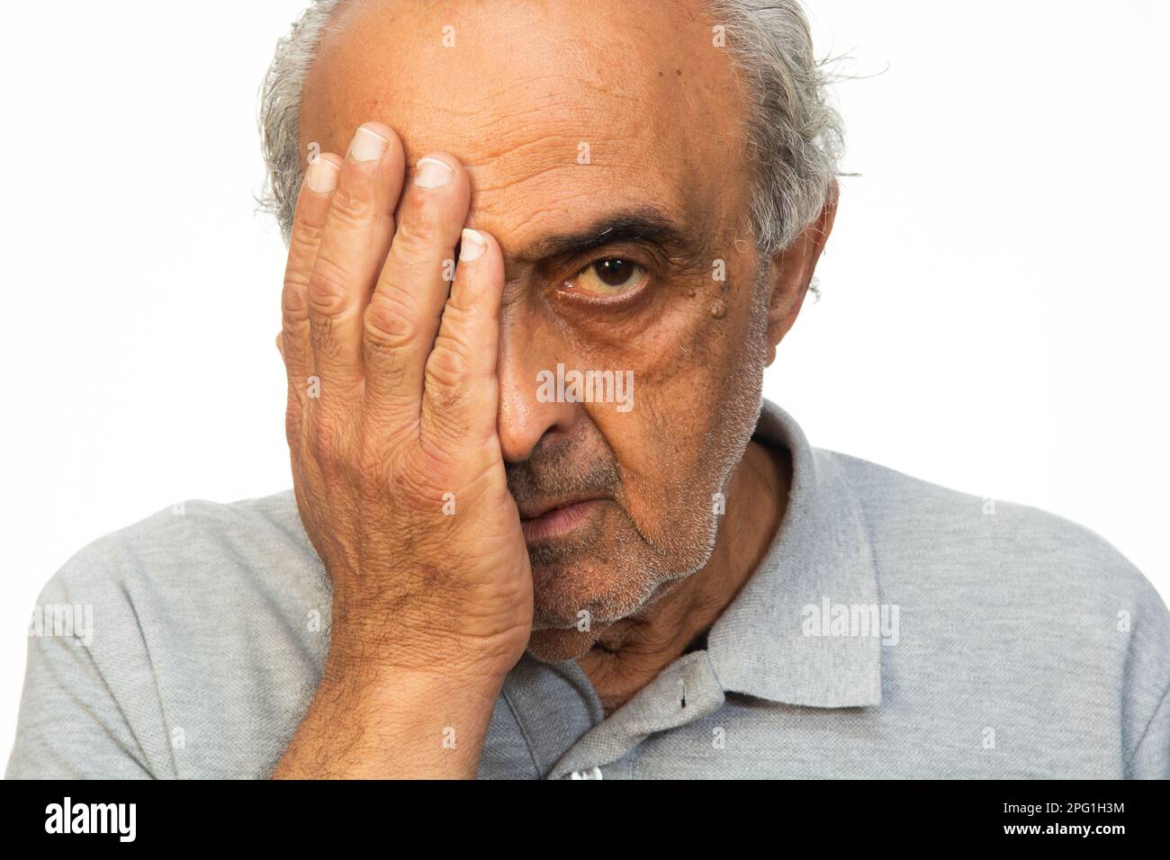 Triste vecchio uomo mano sopra occhio guardando la macchina fotografica Foto Stock