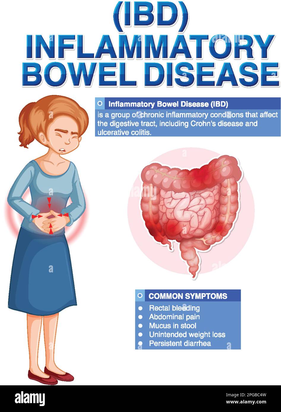 Infografica sulla malattia infiammatoria intestinale (IBD) Illustrazione Vettoriale