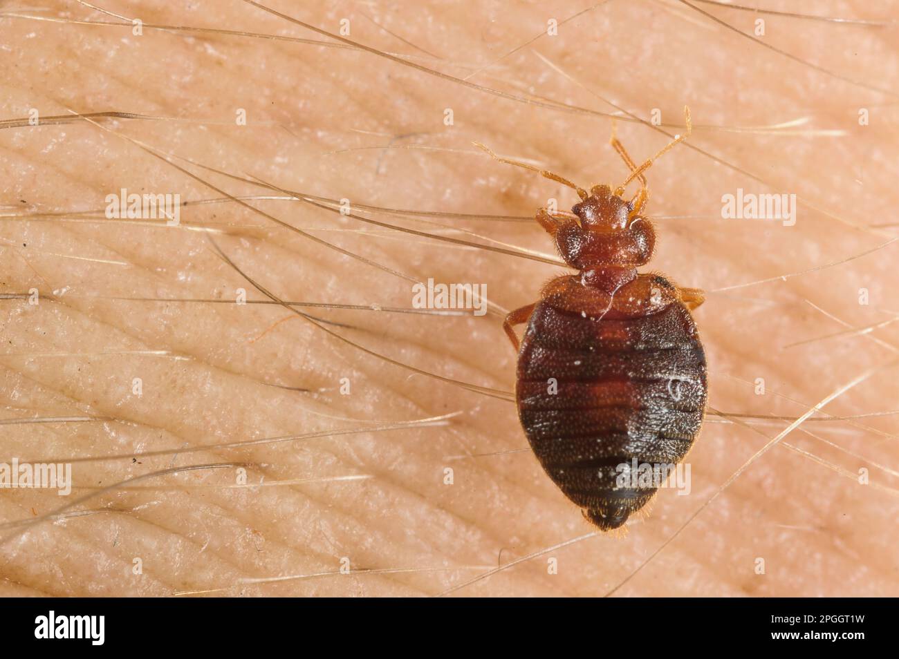 Beccato comune (Cimex lectularius) adulto, succhiando il sangue dalla pelle umana, Italia Foto Stock