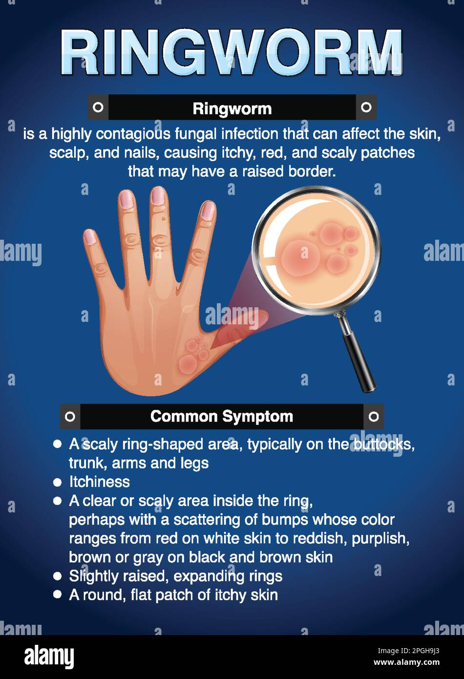 Poster informativo dell'illustrazione del ringworm Illustrazione Vettoriale