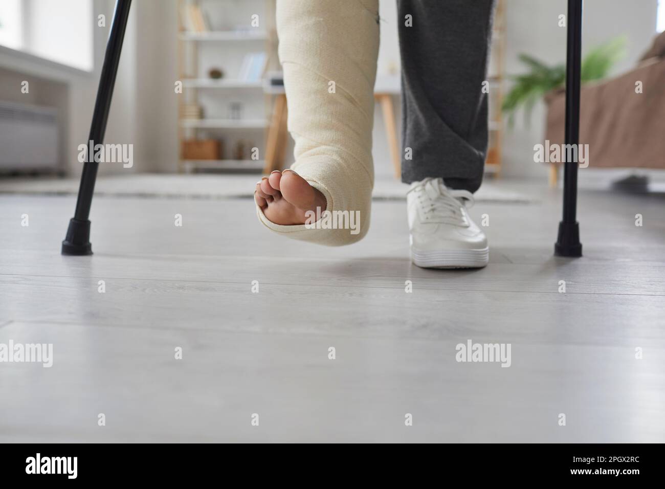 Una giovane donna malsana con lesioni alle gambe o ai piedi rotte è in fase di riabilitazione a casa. Ragazza è in piedi nel soggiorno su stampelle con Foto Stock