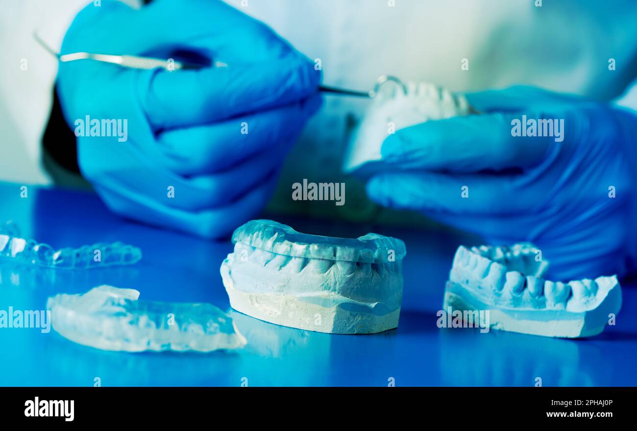 primo piano di un dentista, indossando guanti in lattice blu, regolando una stecca occlusale, utilizzando un getto per bocca Foto Stock