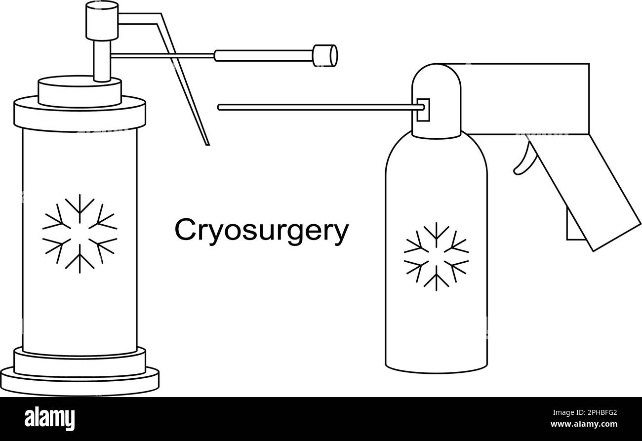 Strumenti criogenici per criochirurgia con linee vettoriali. Raffreddamento ad azoto liquido per trattamento criogenico. Terapia con ghiaccio per lesioni benigne e maligne. Illustrazione Vettoriale