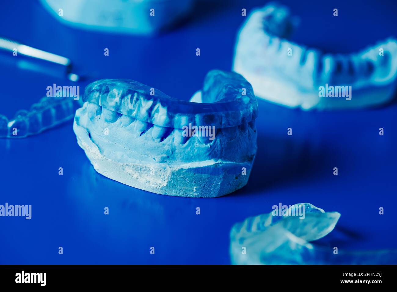 closeup di una stecca occlusale in uno stampo dentale su una superficie blu accanto ad alcuni altri stampi dentale e stecche occlusali Foto Stock