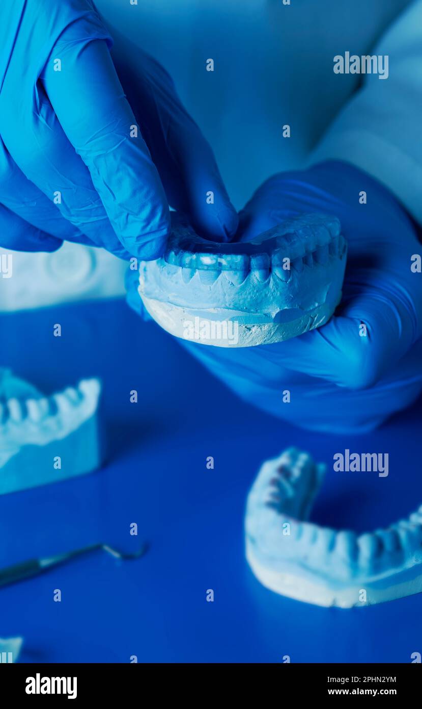 un tecnico, indossando guanti in lattice blu, prova una stecca occlusale blu nel suo stampo dentale Foto Stock