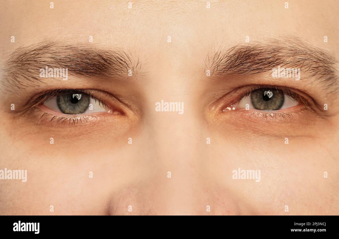 Uomo stanco con cerchi scuri sotto gli occhi, primo piano Foto Stock