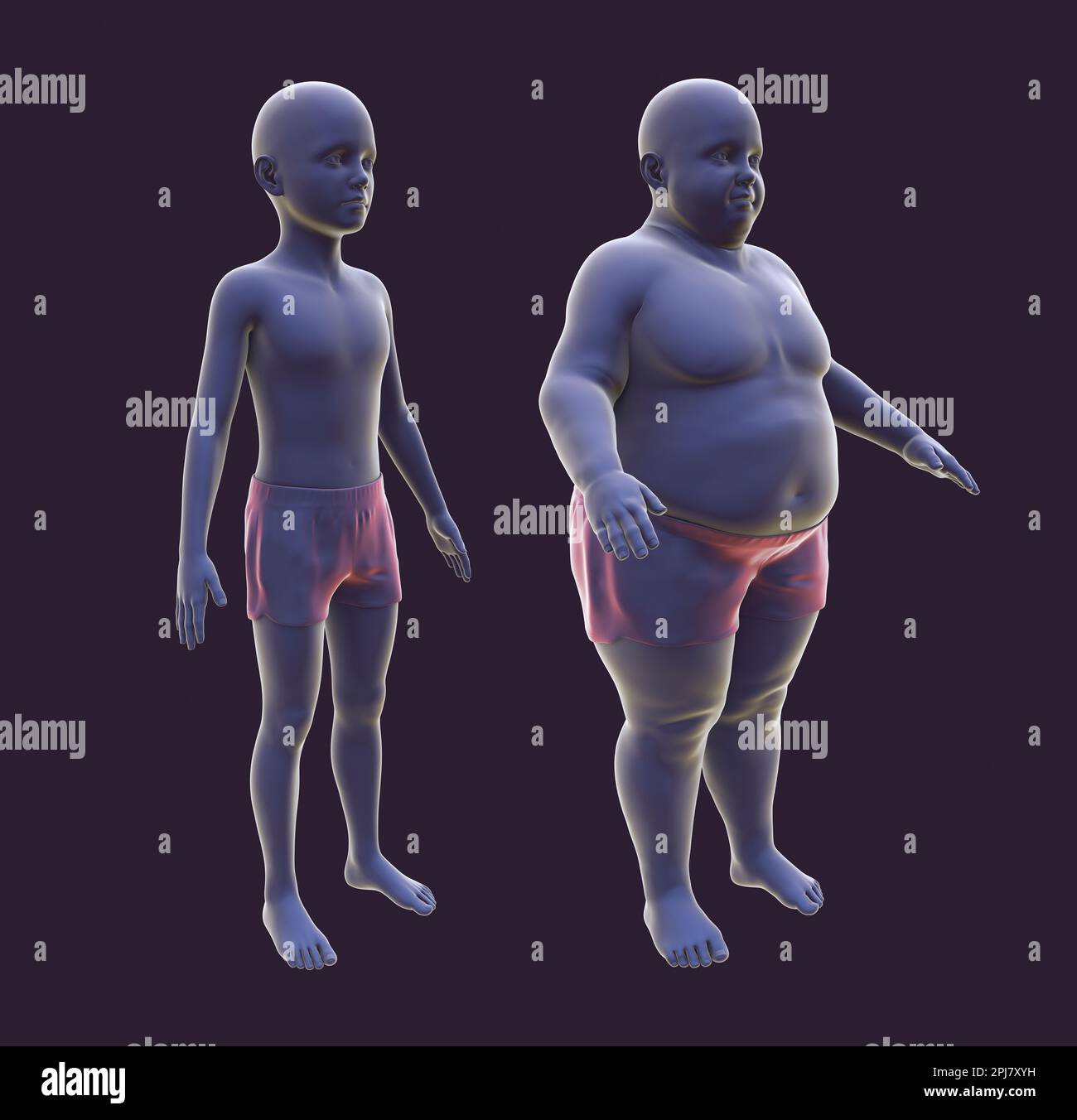 Ragazzo prima e dopo aver guadagnato peso, illustrazione Foto Stock