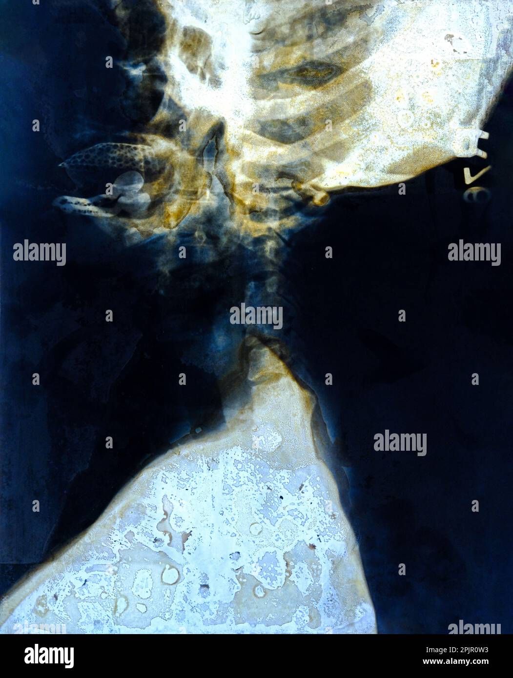 Vista laterale radiologica del cranio e della colonna cervicale. Cranio AP e colonna cervicale Foto Stock