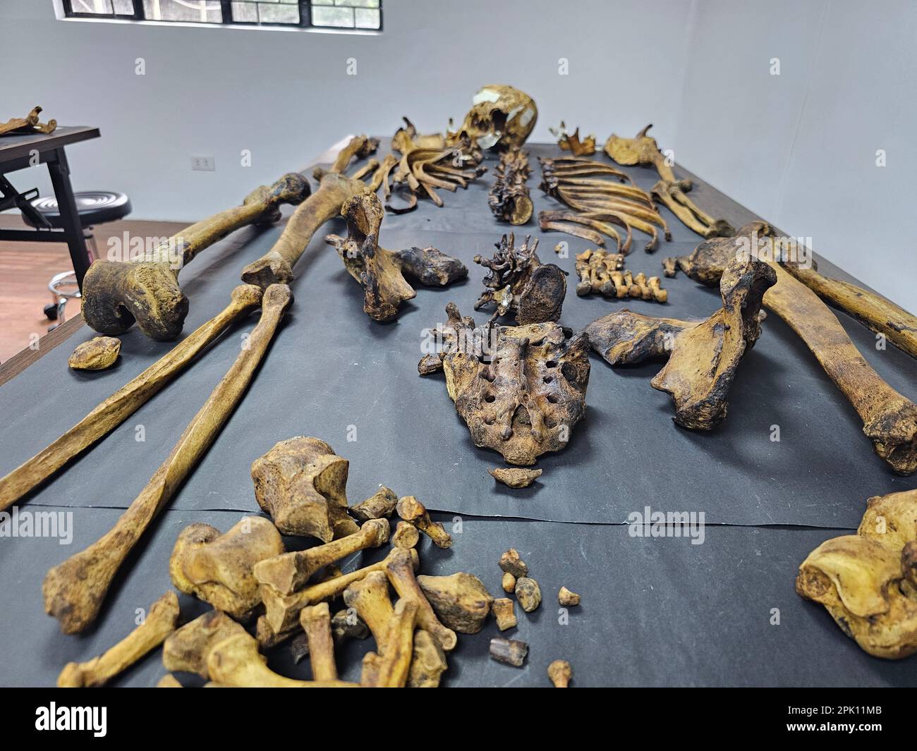 Manila, Filippine. 04th Apr, 2023. Il patologo forense Dr. Raquel Fortun esamina gli scheletri esumati delle vittime della guerra di droga a Caloocan City. (Foto di Sherbien Dacalanio/Pacific Press) Credit: Pacific Press Media Production Corp./Alamy Live News Foto Stock