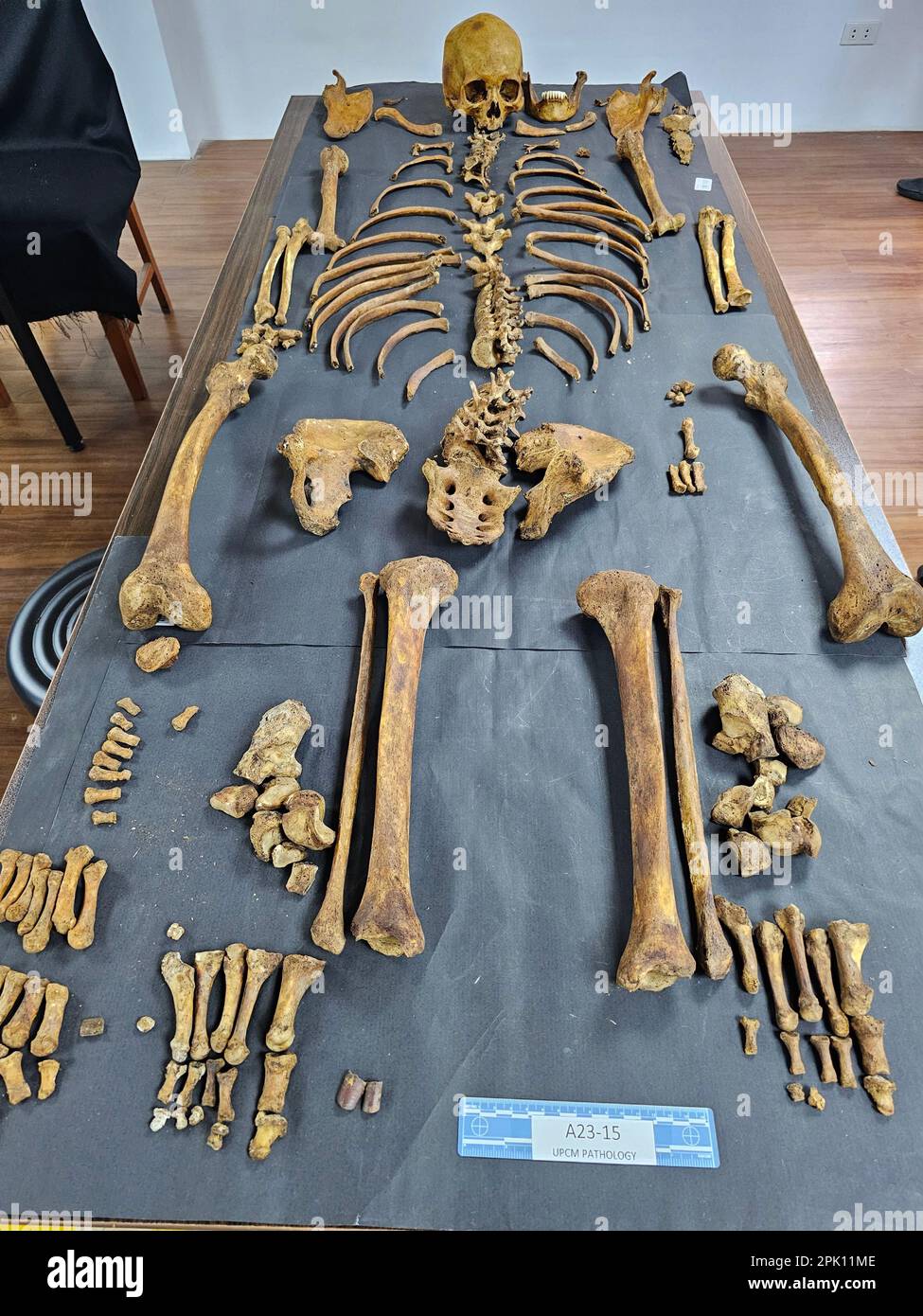 Manila, Filippine. 04th Apr, 2023. Il patologo forense Dr. Raquel Fortun esamina gli scheletri esumati delle vittime della guerra di droga a Caloocan City. (Foto di Sherbien Dacalanio/Pacific Press) Credit: Pacific Press Media Production Corp./Alamy Live News Foto Stock
