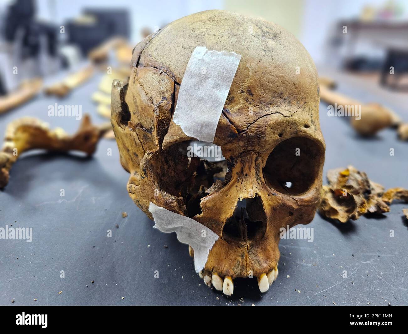 Manila, Filippine. 04th Apr, 2023. Il patologo forense Dr. Raquel Fortun esamina gli scheletri esumati delle vittime della guerra di droga a Caloocan City. (Foto di Sherbien Dacalanio/Pacific Press) Credit: Pacific Press Media Production Corp./Alamy Live News Foto Stock