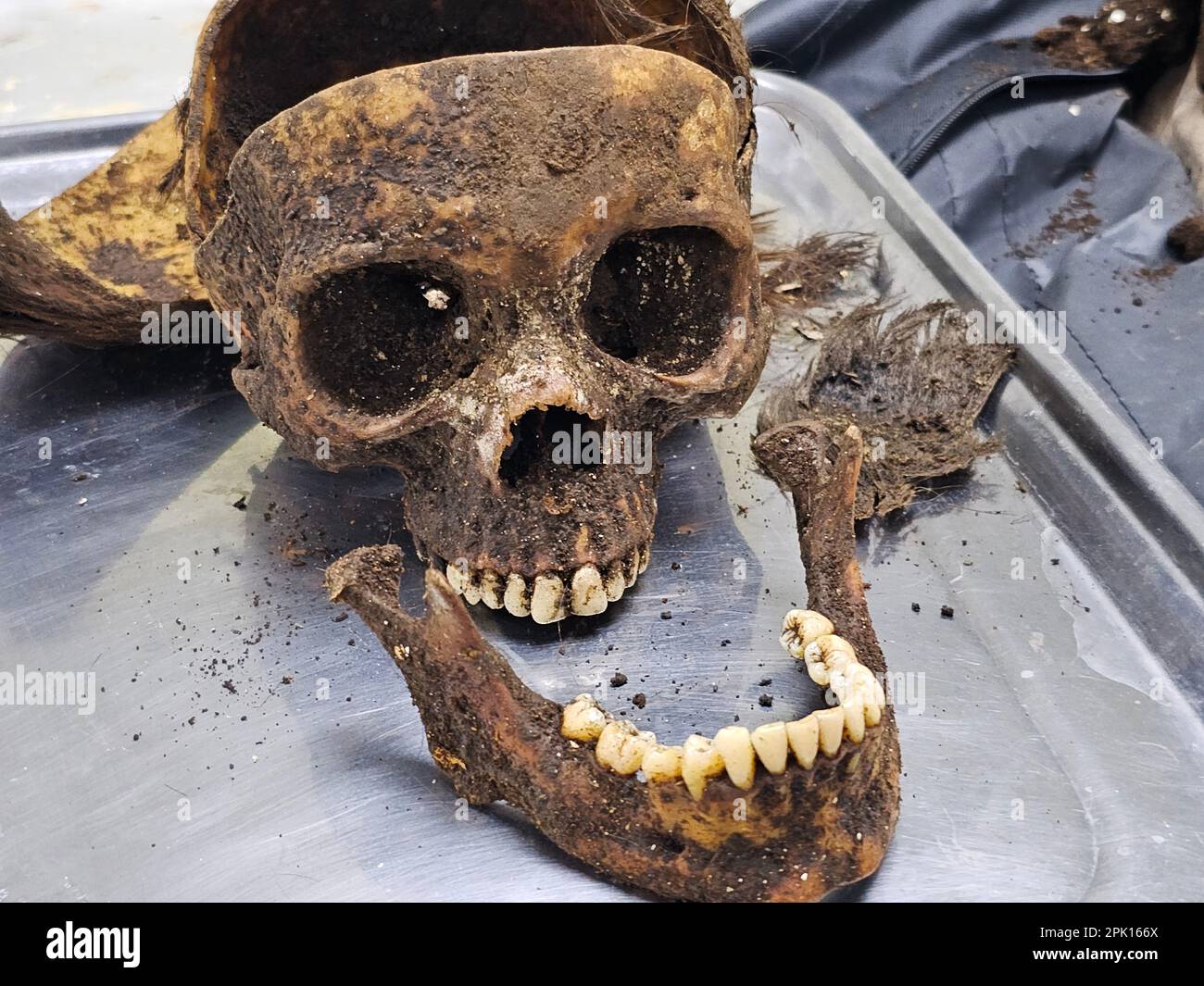 Manila, Regione della capitale nazionale, Filippine. 4th Apr, 2023. Il patologo forense Dr. Raquel Fortun esamina gli scheletri esumati delle vittime della guerra di droga a Caloocan City. (Credit Image: © Sherbien Dacalanio/Pacific Press via ZUMA Press Wire) SOLO PER USO EDITORIALE! Non per USO commerciale! Foto Stock