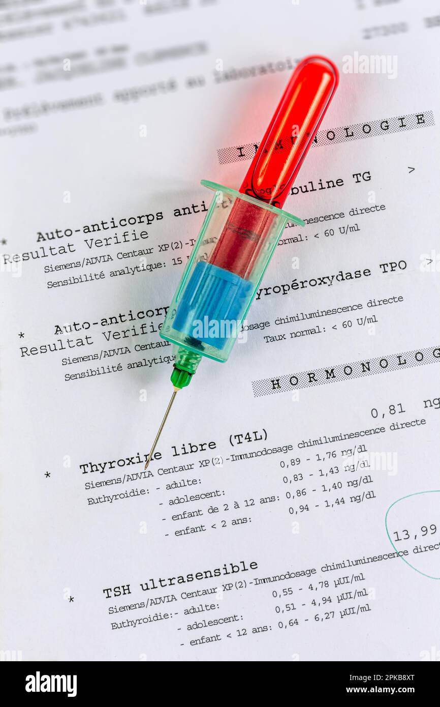 Corpo del campione con provetta di sangue piena, posizionato sui risultati dell'analisi. Foto Stock