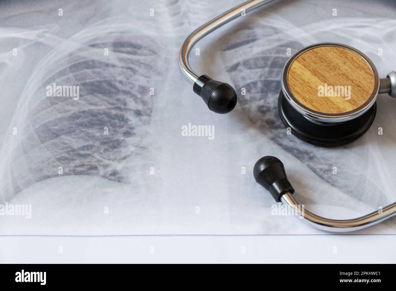 Immagine fluorografica dei polmoni su carta e uno stetoscopio, polmoni sani di un uomo per un esame di routine Foto Stock