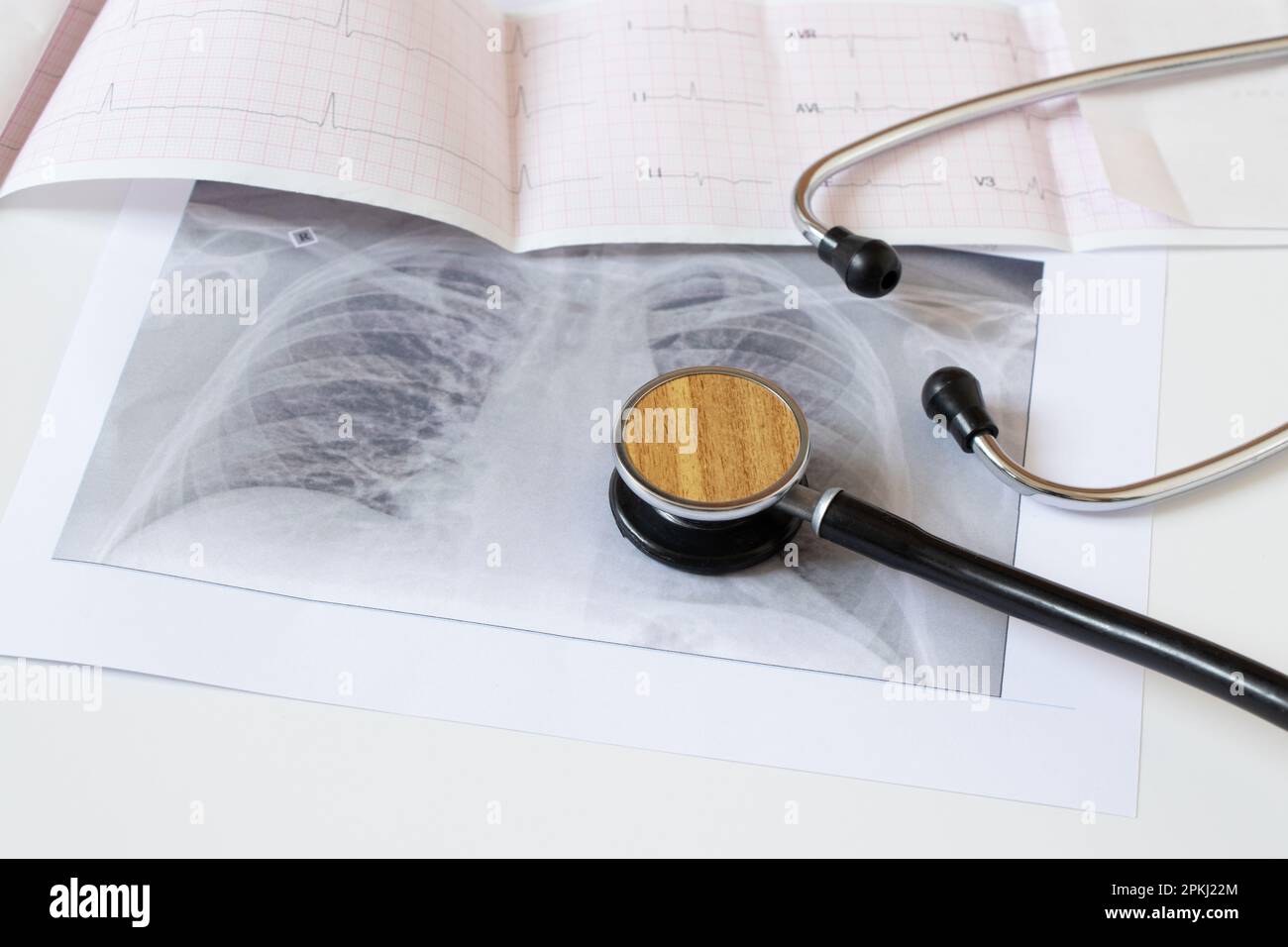 Immagine fluorografica dei polmoni su carta e un cardiogramma e uno stetoscopio su sfondo bianco, polmoni umani sani per l'esame di routine, healt Foto Stock
