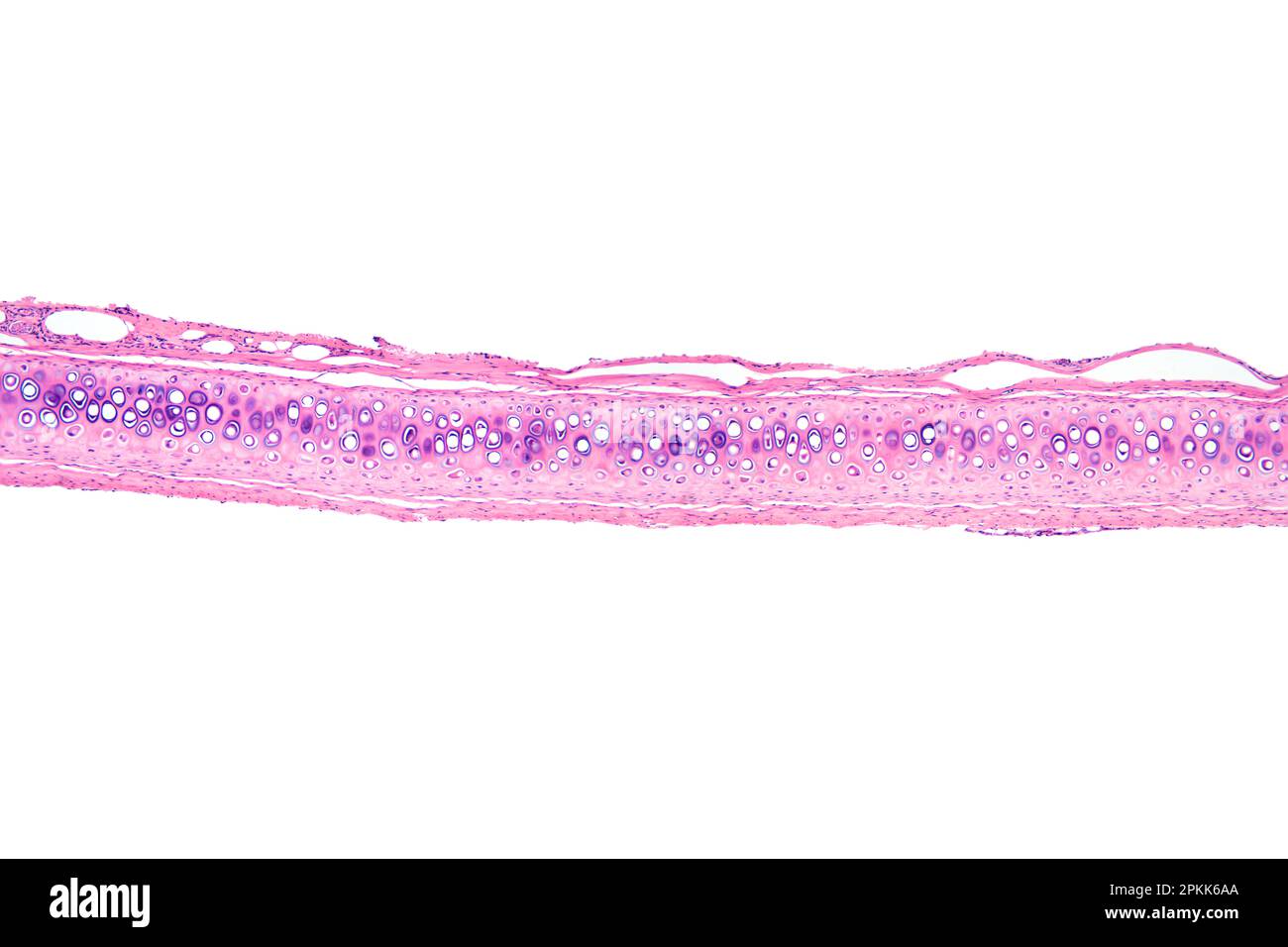 Cellule ossee, sezione, micrografia a luce 20X. Osso compatto con osteoni o sistema o canali haversiani, colorato con ematossilina-eosina, al microscopio ottico. Foto Stock
