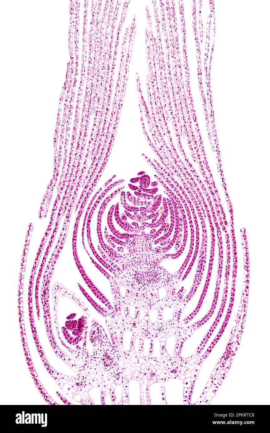 Germoglio apicale di una pianta acquatica, sezione longitudinale attraverso la parte superiore di una ripresa terminale, micrografia a 20X luci. Germogli macchiati di eosina. Foto Stock