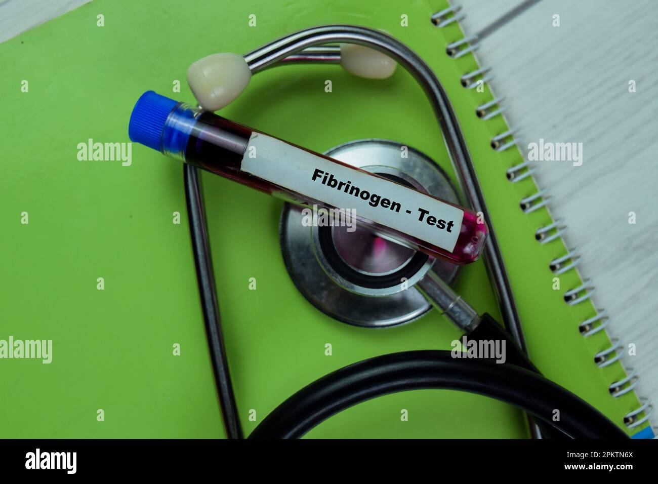 Concetto di fibrinogeno - eseguire il test con un campione di sangue. Concetto sanitario o medico Foto Stock