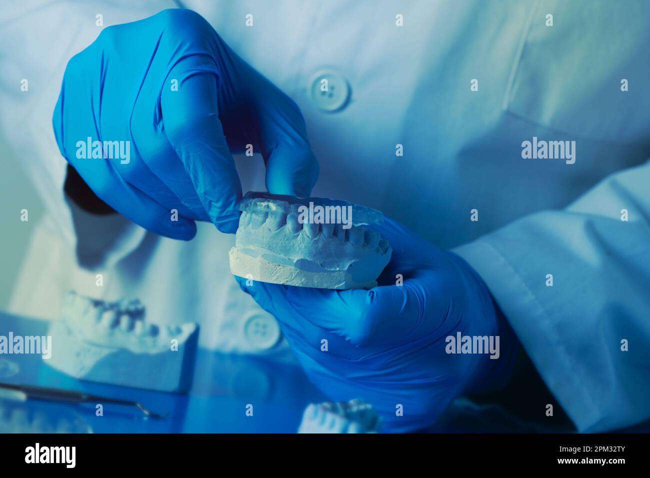 primo piano di un dentista, indossando guanti in lattice blu, testando una stecca occlusale nella sua muffa dentale Foto Stock