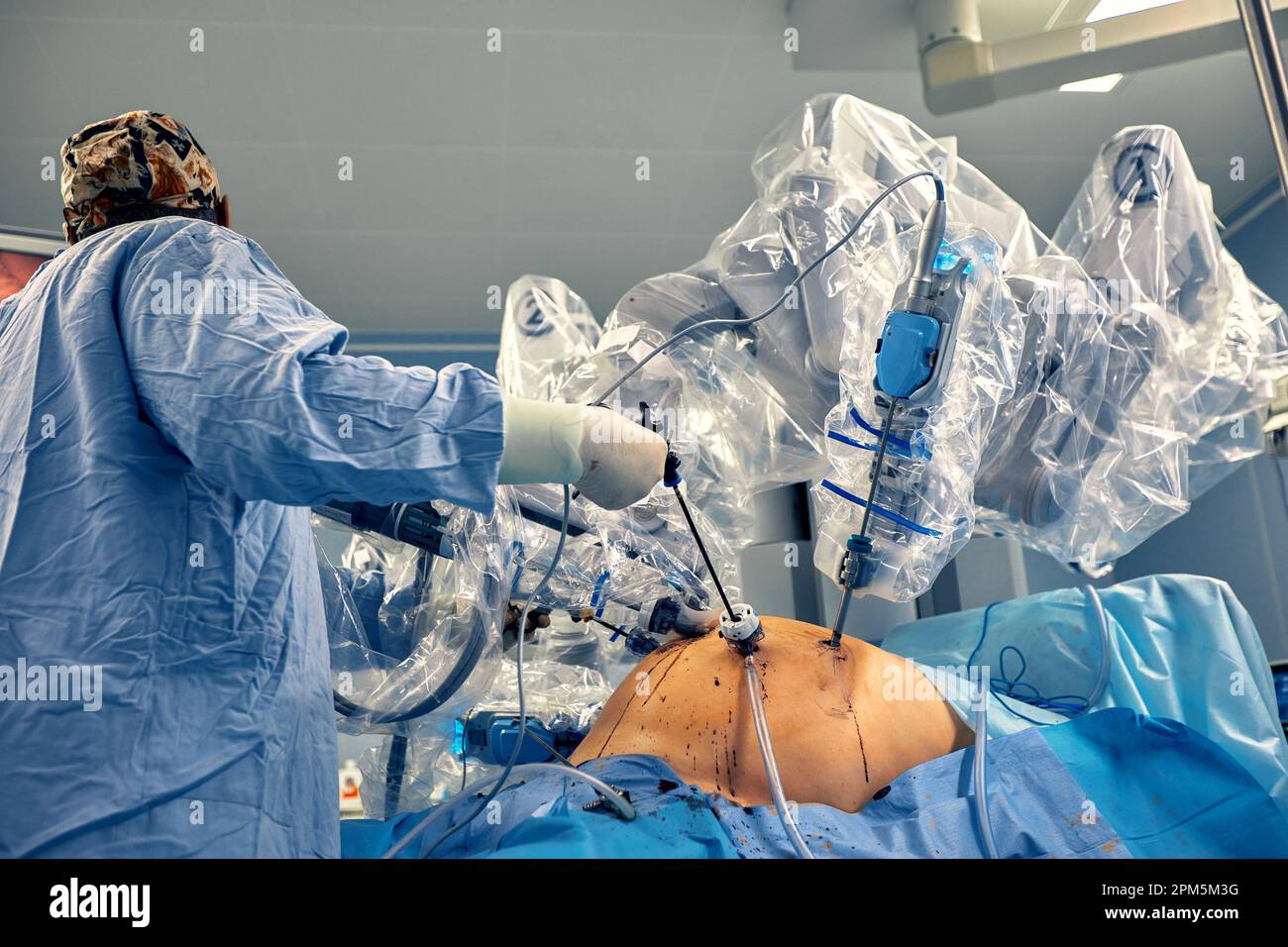 Chirurgia da Vinci. Chirurgia robotica minimamente invasiva con il sistema chirurgico da Vinci. robot medico. Chirurgia robotica. Operati medici assistiti da robot Foto Stock