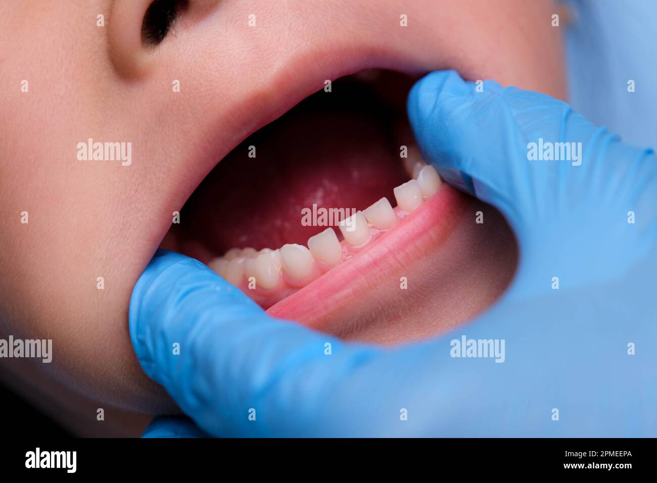 Primo piano all'interno della cavità orale di un bambino sano con belle file di denti del bambino. La giovane ragazza apre la bocca rivelando i denti superiori e inferiori, PAL duro Foto Stock