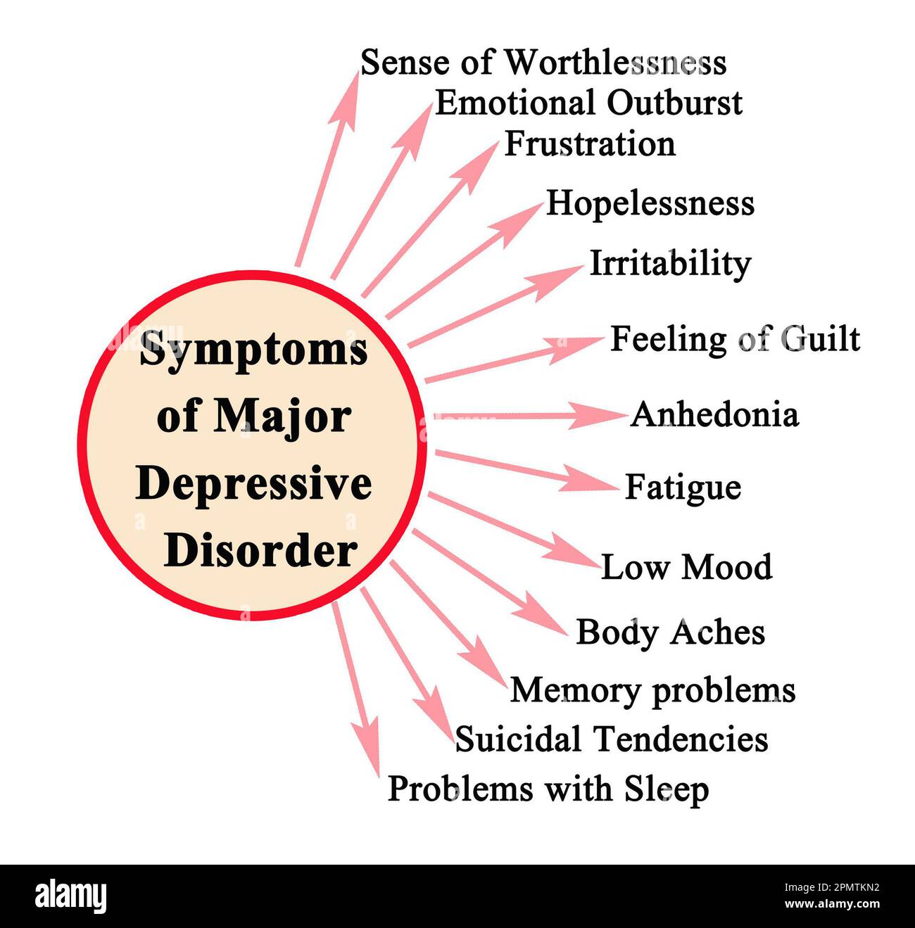 Sintomi di disturbo depressivo maggiore Foto Stock