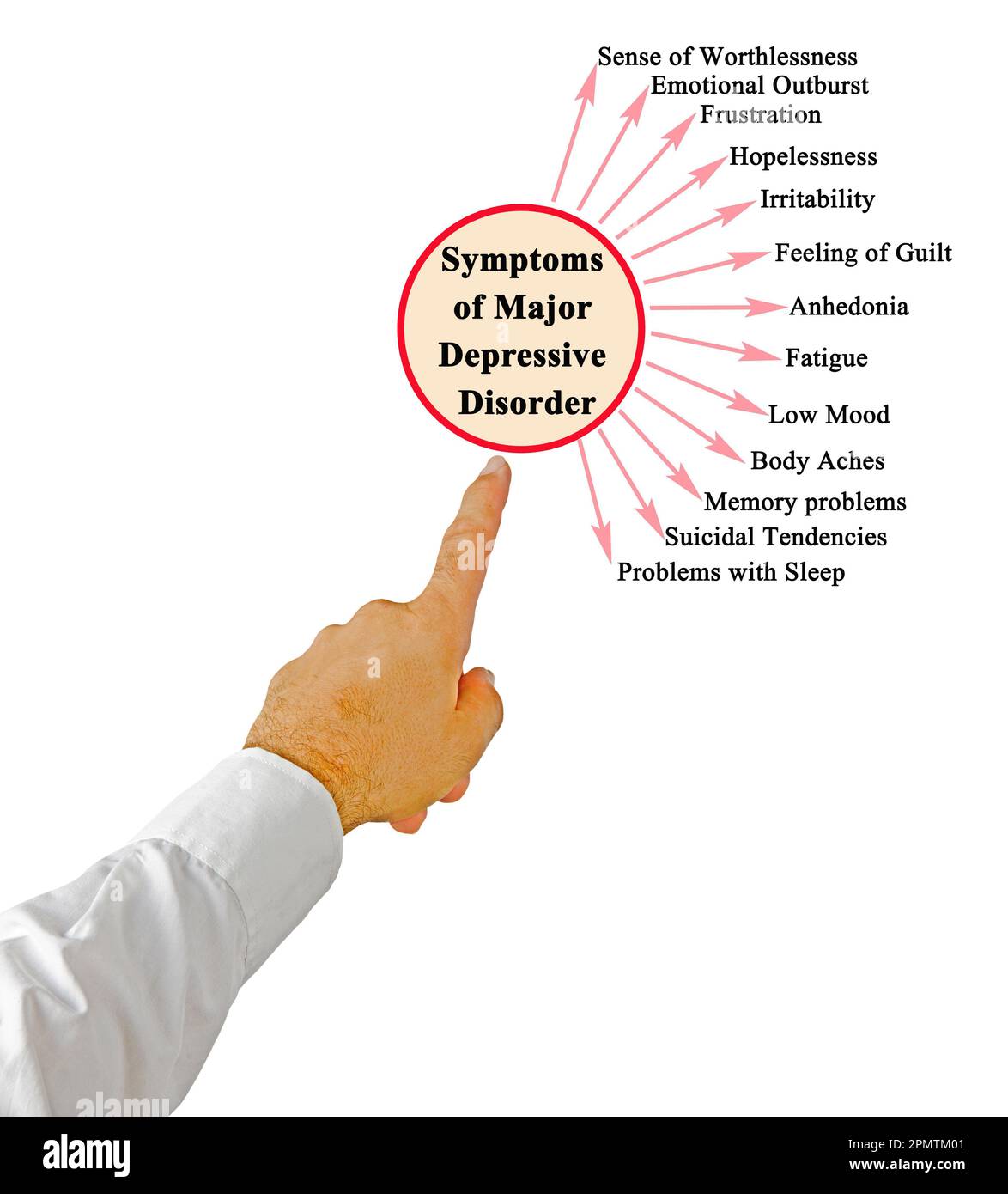 Sintomi di disturbo depressivo maggiore Foto Stock