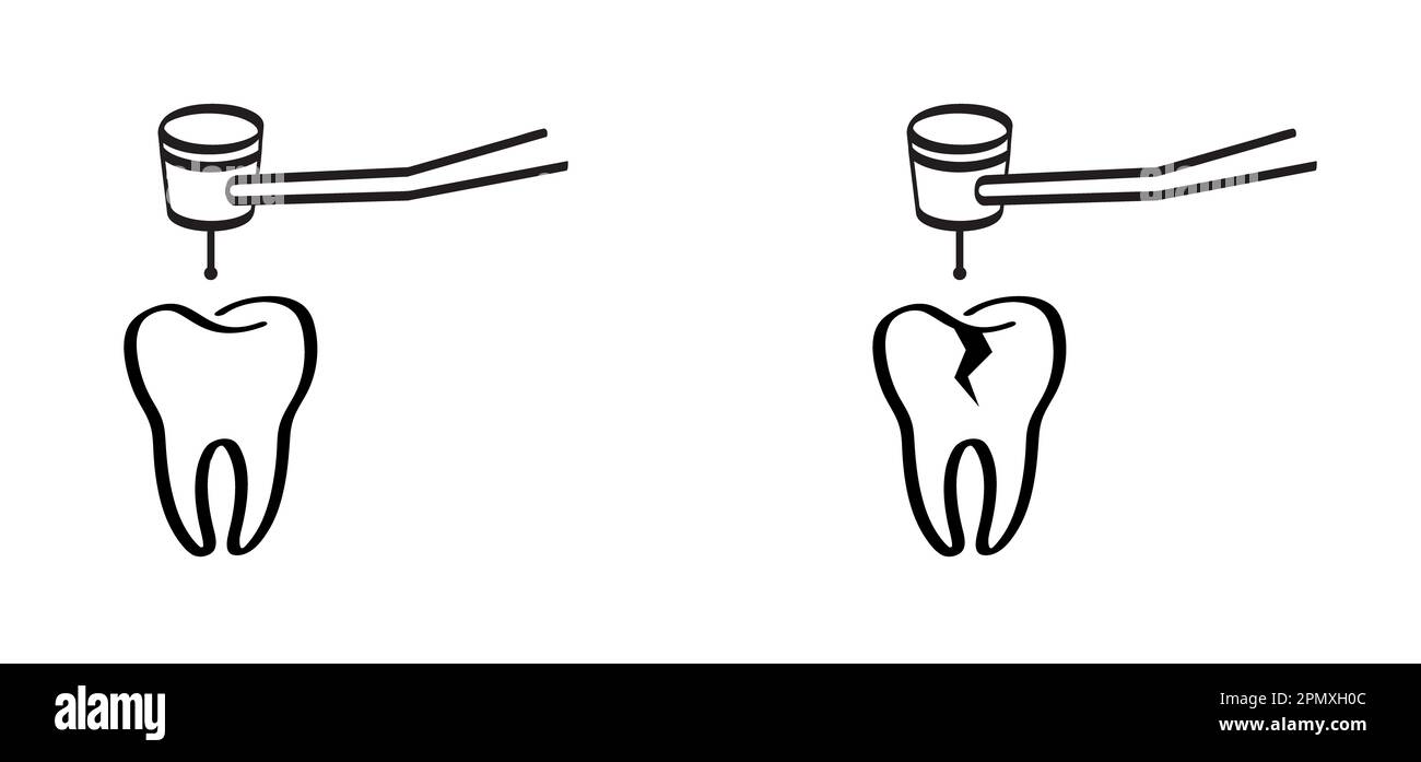Dentale o dentale per clinica dentale. Dente cartoon con gengive e drill, logo molare. Danneggiare la spazzola per denti o la spazzola per denti con carie. M Foto Stock