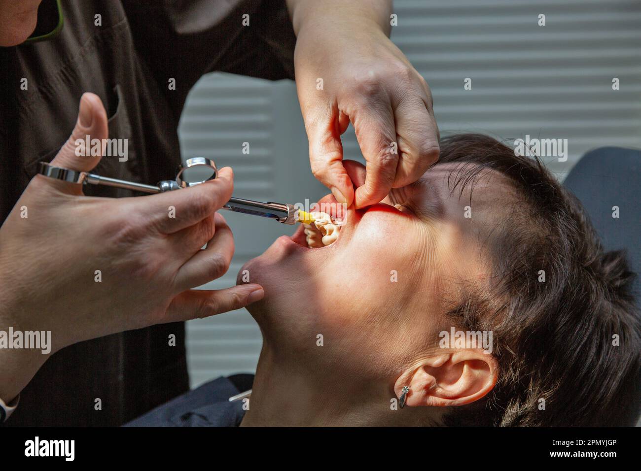 Dentista che lavora con un paziente in un dentista. Il medico fa un'iniezione di anestetico nel closeup gengivale Foto Stock