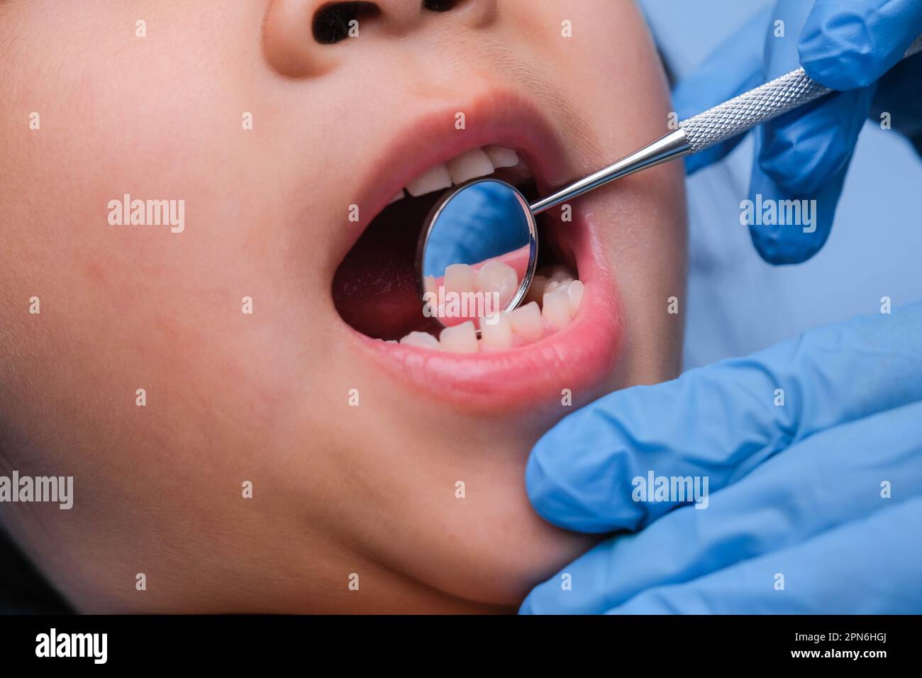 Primo piano nella cavità orale di un bambino sano con bei denti bianchi. La giovane ragazza apre la bocca per rivelare denti sani, palato duro e morbido. D Foto Stock