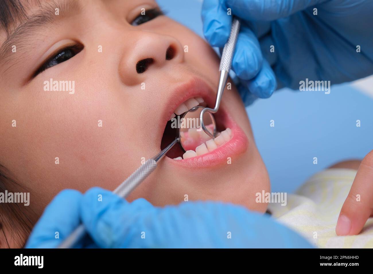 Primo piano nella cavità orale di un bambino sano con bei denti bianchi. La giovane ragazza apre la bocca per rivelare denti sani, palato duro e morbido. D Foto Stock