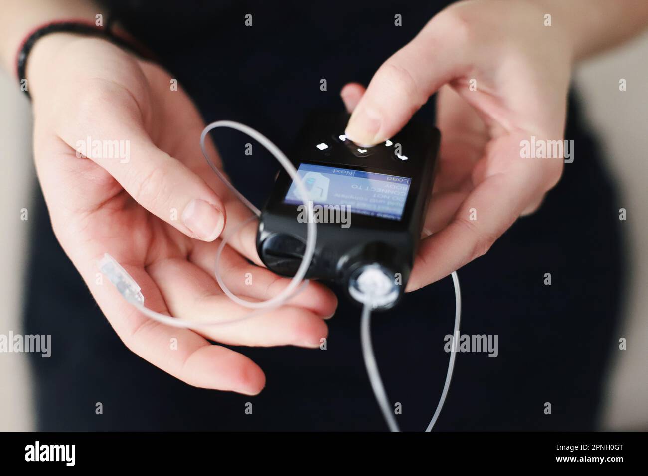 Donna che tiene in mano il suo tiralatte per insulina Foto Stock