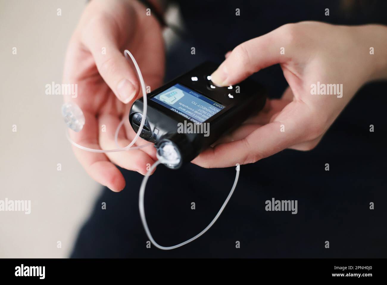 Donna che tiene in mano il suo tiralatte per insulina Foto Stock