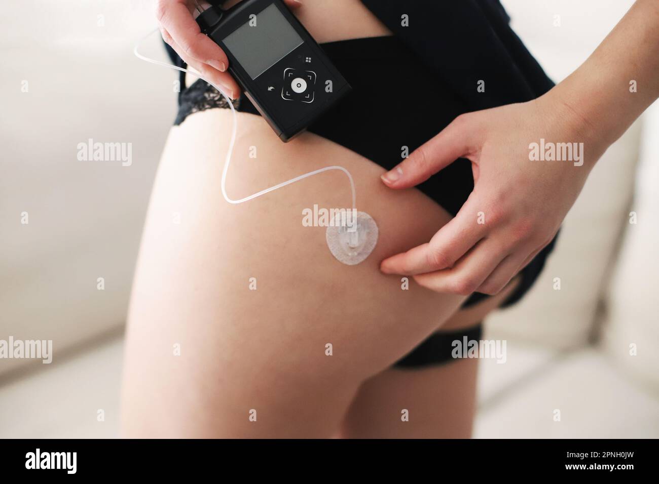 Donna che collega la pompa per insulina al set per infusione nel suo corpo Foto Stock