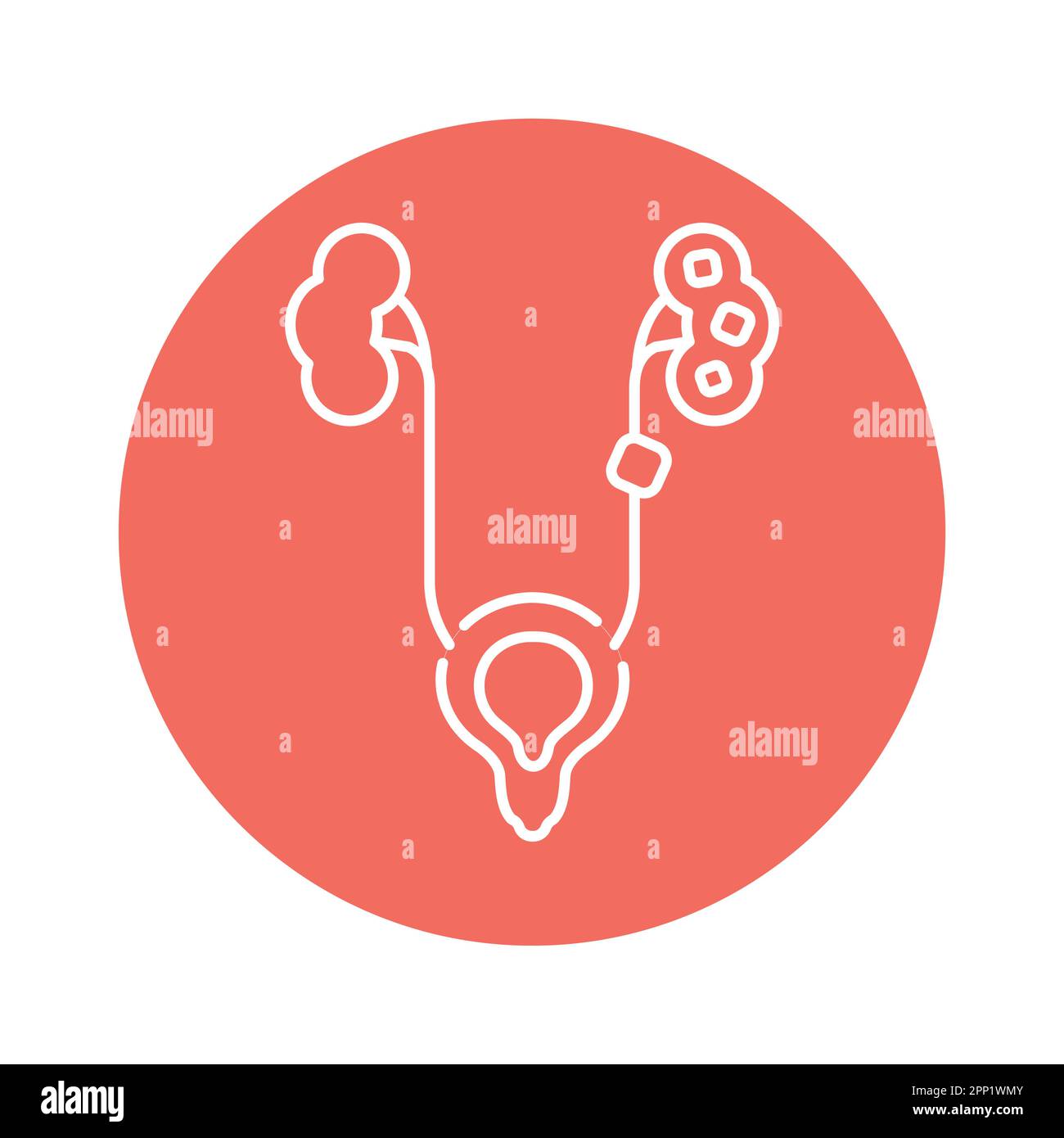 Icona della linea di colore della malattia di urolitiasi. Pittogramma per pagina web, app mobile, promo. Illustrazione Vettoriale